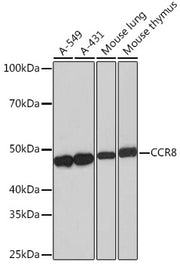 CCR8 Rabbit mAb