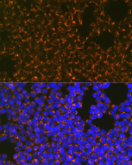 CCR8 Rabbit mAb