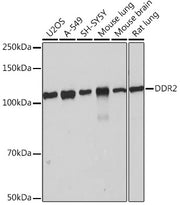 DDR2 Rabbit mAb