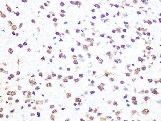 THOC4/ALYREF Rabbit mAb