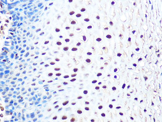 THOC4/ALYREF Rabbit mAb