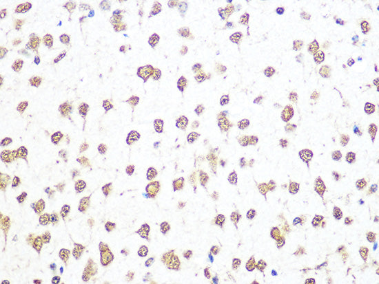 THOC4/ALYREF Rabbit mAb