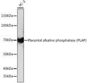 Placental alkaline phosphatase (PLAP) Rabbit mAb