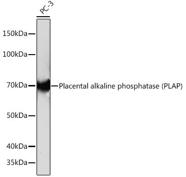 Placental alkaline phosphatase (PLAP) Rabbit mAb