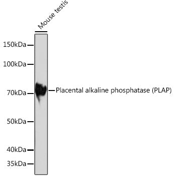Placental alkaline phosphatase (PLAP) Rabbit mAb