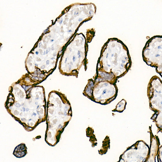 Placental alkaline phosphatase (PLAP) Rabbit mAb