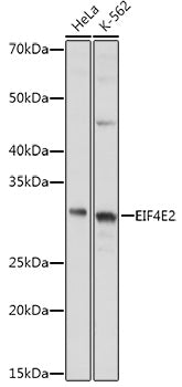 EIF4E2 Rabbit pAb