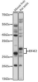 EIF4E2 Rabbit pAb