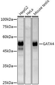 GATA4 Rabbit mAb