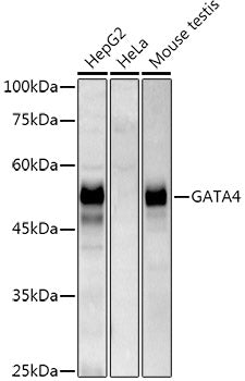 GATA4 Rabbit mAb