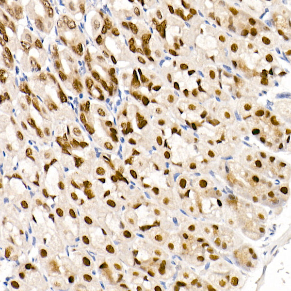 GATA4 Rabbit mAb