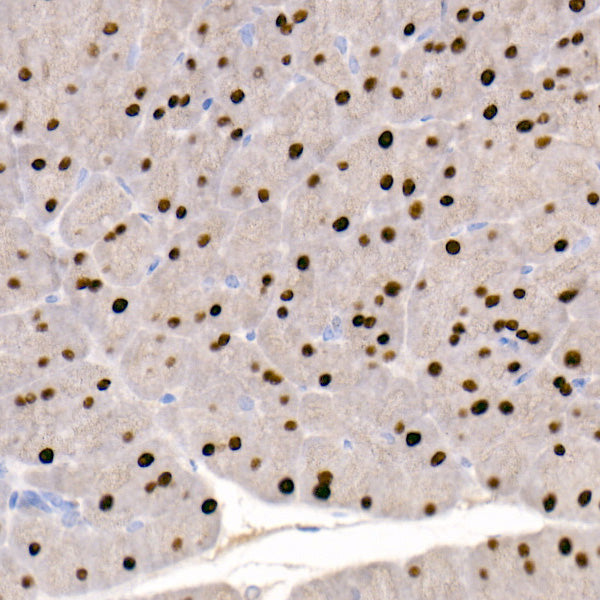 GATA4 Rabbit mAb