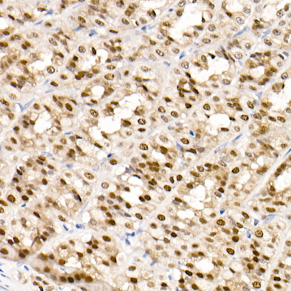 GATA4 Rabbit mAb