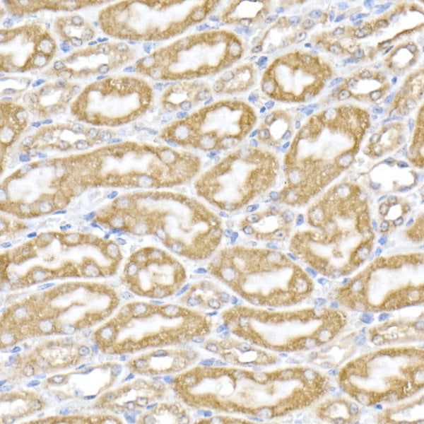 PDIA4 Rabbit pAb