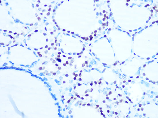 Histone H1.0 Rabbit mAb