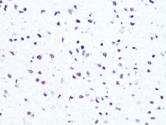 HMGA1 Rabbit mAb