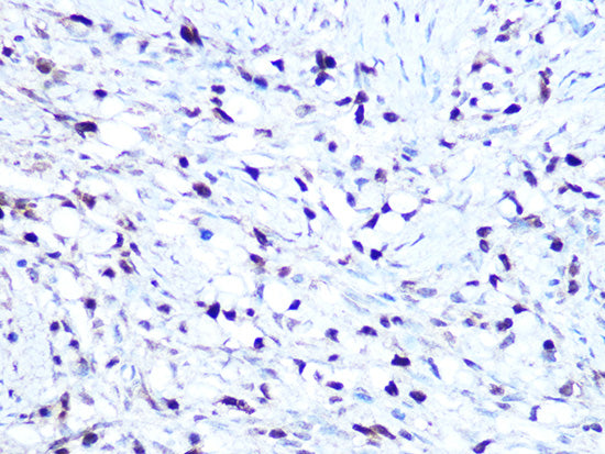 HMGA1 Rabbit mAb