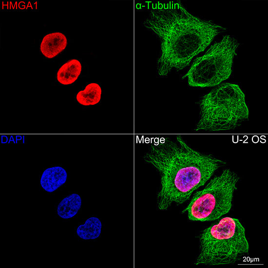 HMGA1 Rabbit mAb