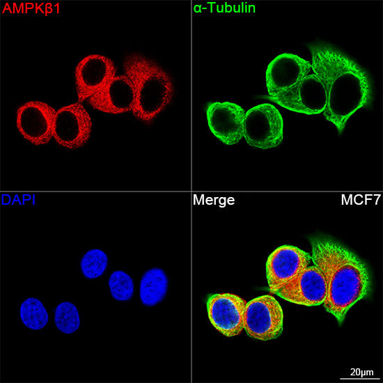 AMPKβ1 Rabbit mAb