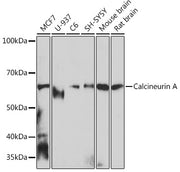 Calcineurin A Rabbit mAb