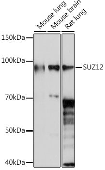 SUZ12 Rabbit mAb
