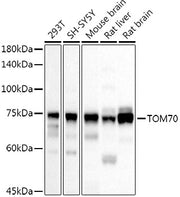 TOM70 Rabbit pAb