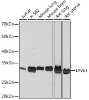 LYVE1 Rabbit mAb