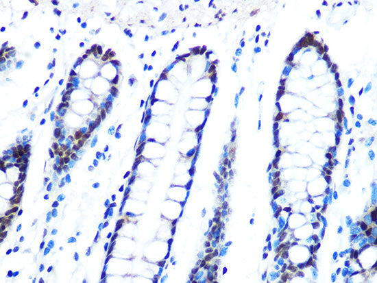 DYNLL1 Rabbit mAb