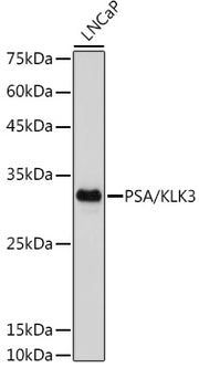 PSA/KLK3 Rabbit mAb