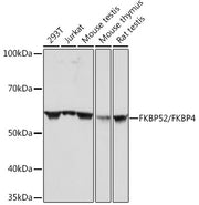 FKBP52/FKBP4 Rabbit mAb