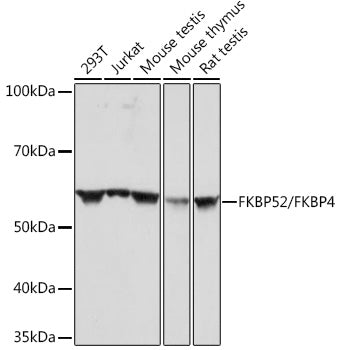 FKBP52/FKBP4 Rabbit mAb