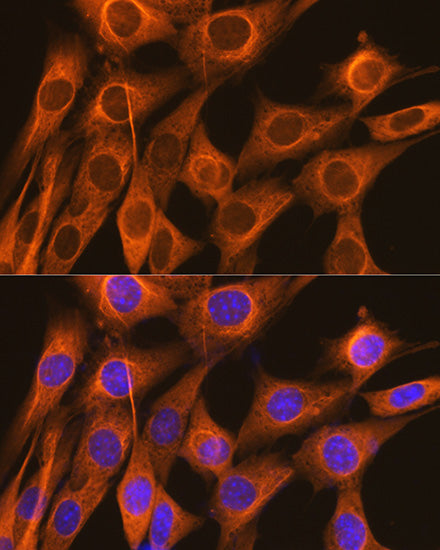 FKBP52/FKBP4 Rabbit mAb