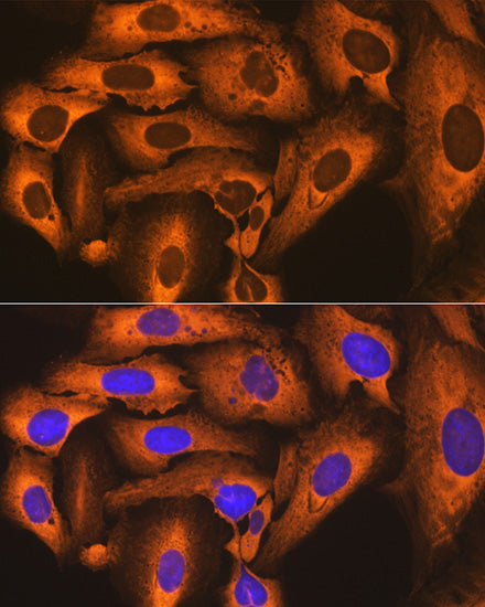 FKBP52/FKBP4 Rabbit mAb