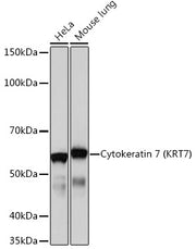 Cytokeratin 7 (KRT7) Rabbit mAb