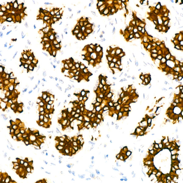 Cytokeratin 7 (KRT7) Rabbit mAb
