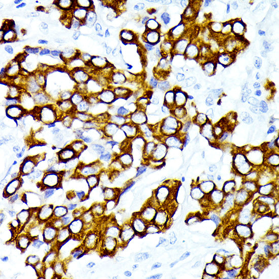 Cytokeratin 7 (KRT7) Rabbit mAb