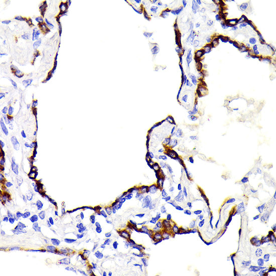 Cytokeratin 7 (KRT7) Rabbit mAb