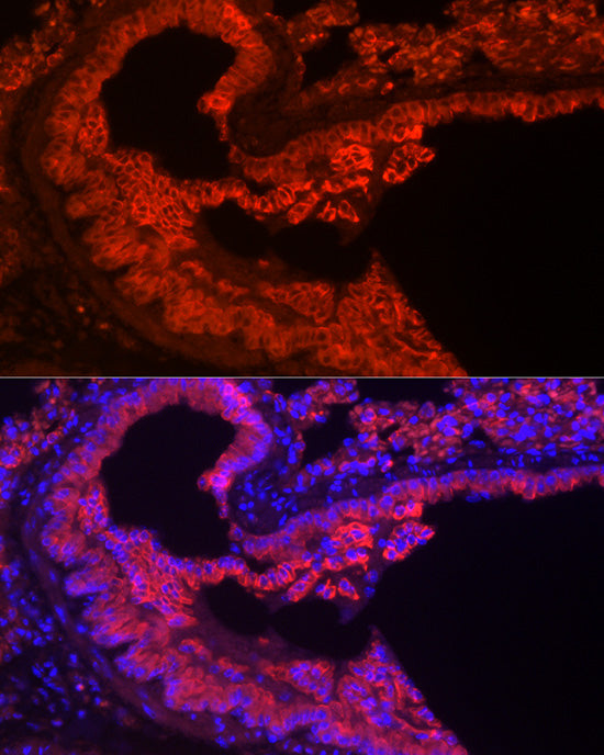 Cytokeratin 7 (KRT7) Rabbit mAb
