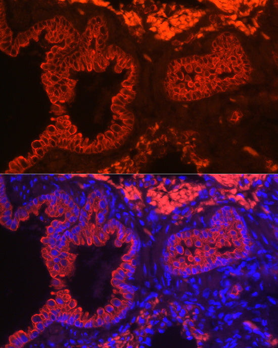 Cytokeratin 7 (KRT7) Rabbit mAb
