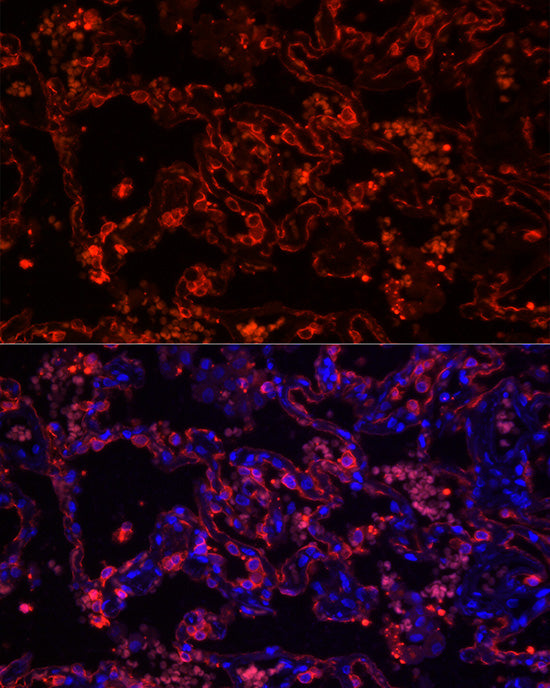 Cytokeratin 7 (KRT7) Rabbit mAb