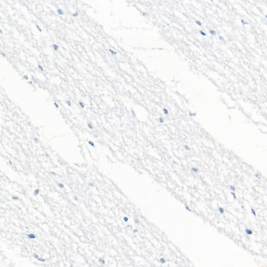 CD79B Rabbit mAb