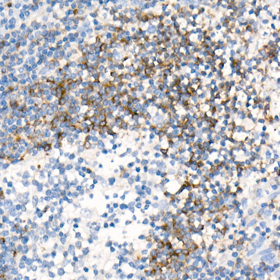CD79B Rabbit mAb