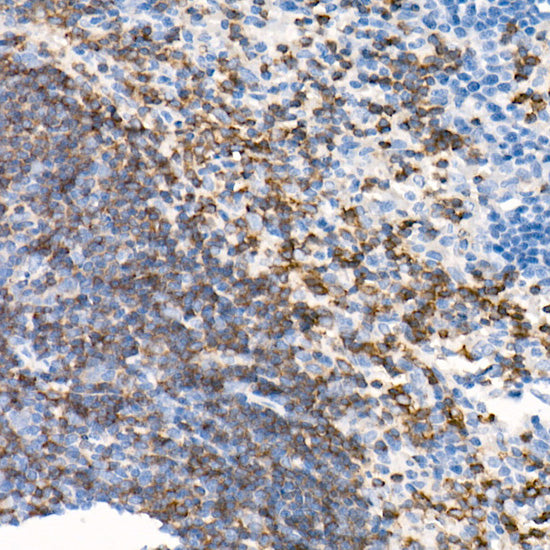 CD79B Rabbit mAb