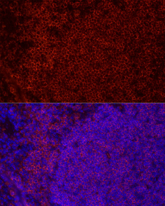 CD79B Rabbit mAb