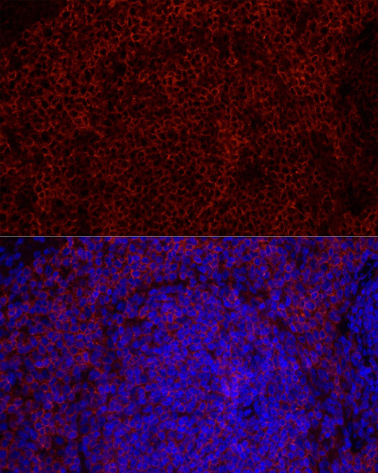 CD79B Rabbit mAb
