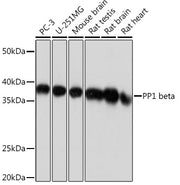 PP1 beta Rabbit mAb