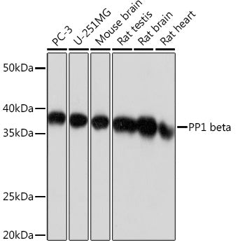 PP1 beta Rabbit mAb