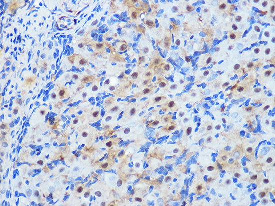 PP1 beta Rabbit mAb