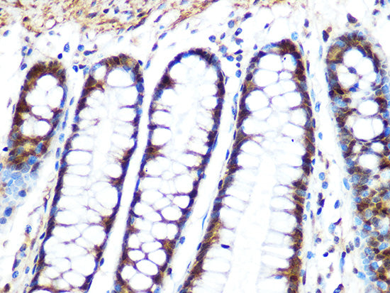 PP1 beta Rabbit mAb