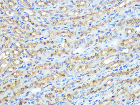 PP1 beta Rabbit mAb